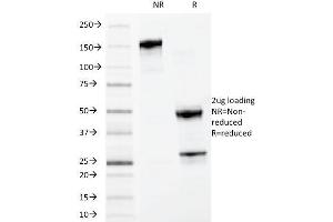 SDS-PAGE Analysis Purified MYDAM Monoclonal Antibody (MYADM/972). (MYADM antibody)