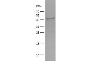 Western Blotting (WB) image for Eukaryotic Translation Initiation Factor 2-alpha Kinase 1 (EIF2AK1) (AA 1-194) protein (His-IF2DI Tag) (ABIN7282192) (EIF2AK1 Protein (AA 1-194) (His-IF2DI Tag))