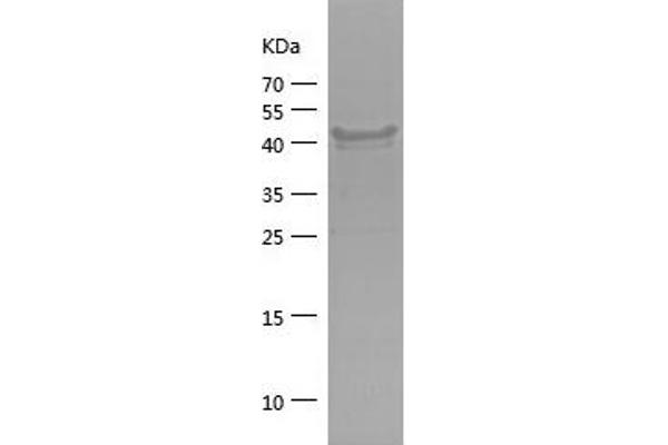 EIF2AK1 Protein (AA 1-194) (His-IF2DI Tag)
