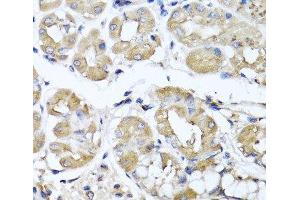 Immunohistochemistry of paraffin-embedded Human stomach using IFNL1 Polyclonal Antibody at dilution of 1:100 (40x lens). (IL29 antibody)