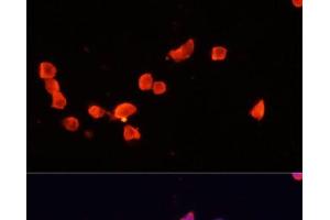 Immunofluorescence analysis of SH-SY5Y cells using CDK5R1 Polyclonal Antibody at dilution of 1:100. (CDK5R1 antibody)