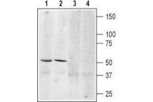 Western blot analysis of mouse (lanes 1 and 3) and rat (lanes 2 and 4) brain lysates: - 1,3. (ADRB3 antibody  (Cys186Ser-Mutant, Extracellular))