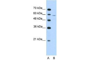 Human Jurkat; WB Suggested Anti-IRX4 Antibody Titration: 2.