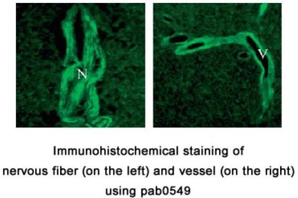 TMTC3 antibody  (C-Term)