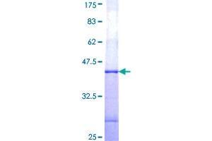 GUCY2F Protein (AA 311-420) (GST tag)
