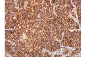 Immunohistochemistry (IHC) image for anti-Receptor tyrosine-protein kinase erbB-2 (ErbB2/Her2) (C-Term) antibody (ABIN870542) (ErbB2/Her2 antibody  (C-Term))