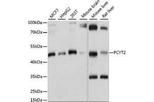 Western blot analysis of extracts of various cell lines, using PCYT2 antibody (ABIN6291655) at 1:1000 dilution. (PCYT2 antibody)