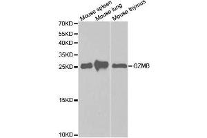 Western blot analysis of extracts of various cell lines, using GZMB antibody. (GZMB antibody  (AA 148-247))