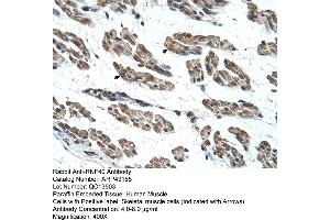 Human Muscle (RNF40 antibody  (C-Term))