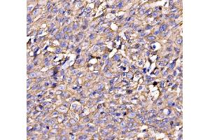 IHC analysis of Drebrin/DBN1 using anti-Drebrin/DBN1 antibody (ABIN7602638). (DBN1 antibody  (AA 9-649))