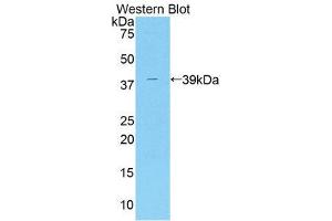 Western Blotting (WB) image for anti-ArfGAP with Dual PH Domains 2 (ADAP2) (AA 49-361) antibody (ABIN1858367) (ADAP2 antibody  (AA 49-361))