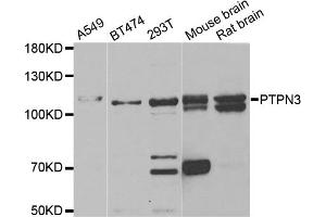 Western blot analysis of extracts of various cell lines, using PTPN3 antibody. (PTPN3 antibody)