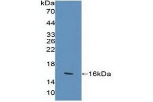 Detection of Recombinant KLRK1, Human using Polyclonal Antibody to Killer Cell Lectin Like Receptor Subfamily K, Member 1 (KLRK1) (KLRK1 antibody  (AA 92-216))