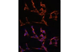 Immunofluorescence (IF) image for anti-Caspase 8 (CASP8) (AA 1-479) antibody (ABIN6137970)