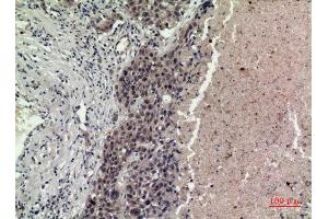 Immunohistochemistry (IHC) analysis of paraffin-embedded Human Lung, antibody was diluted at 1:100. (FGF16 antibody  (Internal Region))