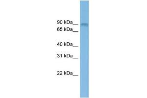 WB Suggested Anti-CENTG1 Antibody Titration: 0.