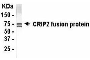 Western Blotting (WB) image for anti-Cysteine-Rich Protein 2 (CRIP2) (AA 1-208) antibody (ABIN2467798)