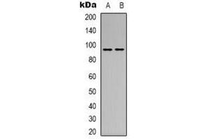 Western blot analysis of CD100 expression in MCF7 (A), L929 (B) whole cell lysates. (SEMA4D/CD100 antibody  (N-Term))