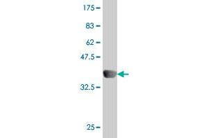 ST6GALNAC2 antibody  (AA 161-270)