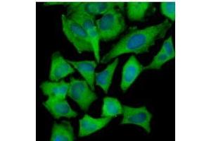 Immunofluorescence (IF) image for anti-Hexokinase 1 (HK1) (AA 1-917), (N-Term) antibody (ABIN317095) (Hexokinase 1 antibody  (N-Term))