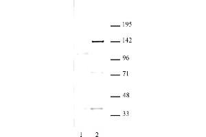 KDM4C antibody (pAb) tested by Western blot.