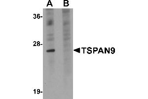 Western Blotting (WB) image for anti-Tetraspanin 9 (TSPAN9) (Middle Region) antibody (ABIN1031151) (Tetraspanin 9 antibody  (Middle Region))