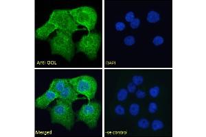 ABIN6391372 Immunofluorescence analysis of paraformaldehyde fixed A431 cells, permeabilized with 0. (CLEC2D antibody  (Internal Region))
