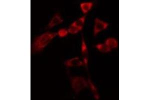 ABIN6275806 staining  Hela cells by IF/ICC. (CYP1B1 antibody  (Internal Region))