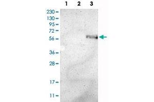 Western Blot analysis of Lane 1: RT-4 cell, Lane 2: U-251 MG sp cell and Lane 3: human plasma tissue (IgG/HSA depleted) lysates with ZMPSTE24 polyclonal antibody .
