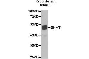 Western blot analysis of extracts of Recombinant protein cell lines, using BHMT antibody. (BHMT antibody  (AA 177-406))