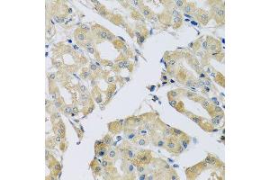 Immunohistochemistry (Paraffin-embedded Sections) (IHC (p)) image for anti-ATP-Binding Cassette, Sub-Family F (GCN20), Member 2 (ABCF2) (AA 1-250) antibody (ABIN1678513)