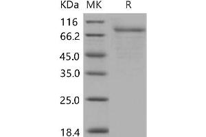 Western Blotting (WB) image for Colony Stimulating Factor 2 Receptor, Alpha, Low-Affinity (Granulocyte-Macrophage) (CSF2RA) (Active) protein (Fc Tag) (ABIN7317137)