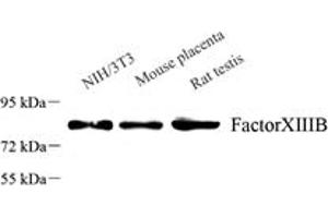 Western blot analysis of F13B (ABIN7073525),at dilution of 1: 1000,Lane 1: NIH3T3 cell lysate,Lane 2: Mouse placenta tissue lysate,Lane 3: Rat testis tissue lysate (F13B antibody)