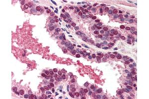 Anti-DFFA / ICAD antibody IHC of human prostate. (DFFA antibody  (AA 313-331))