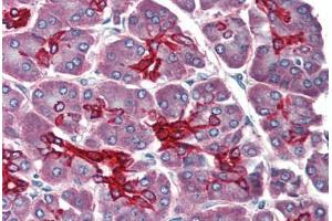 Human Pancreas (formalin-fixed, paraffin-embedded) stained with KRT19 antibody ABIN396942 at 10 ug/ml followed by biotinylated anti-mouse IgG secondary antibody ABIN481714, alkaline phosphatase-streptavidin and chromogen. (Cytokeratin 19 antibody)