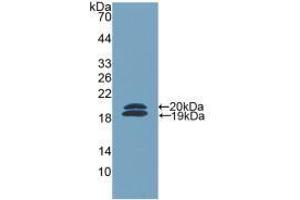 Western blot analysis of recombinant Mouse FCN2. (Ficolin 2 antibody  (AA 97-254))
