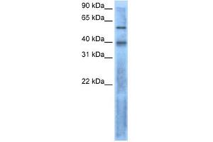 WB Suggested Anti-LEFTY2  Antibody Titration: 0. (LEFTY2 antibody  (N-Term))