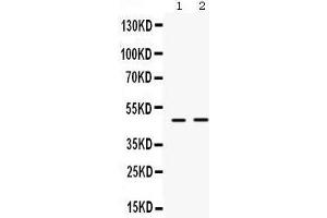 Western Blotting (WB) image for anti-Inhibitor of Growth Family, Member 1 (ING1) (AA 192-223), (Middle Region) antibody (ABIN3042467) (ING1 antibody  (Middle Region))