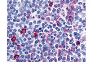 Anti-CCR8 antibody IHC of human tonsil, germinal center. (CCR8 antibody  (N-Term))