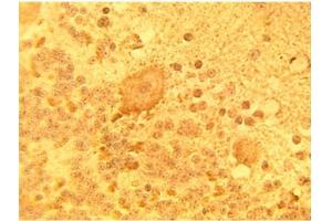 Immunohistochemical staining of normal human brain tissue using DEGS1 Antibody at 15 µg/ml.