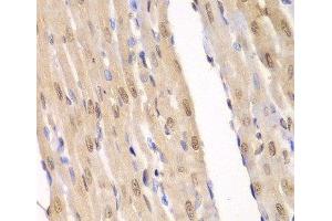 Immunohistochemistry of paraffin-embedded Rat heart using LIG3 Polyclonal Antibody at dilution of 1:100 (40x lens). (LIG3 antibody)