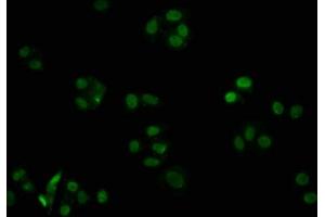 Immunofluorescence (IF) image for anti-Cyclin-Dependent Kinase Inhibitor 1B (p27, Kip1) (CDKN1B) antibody (ABIN7127421)