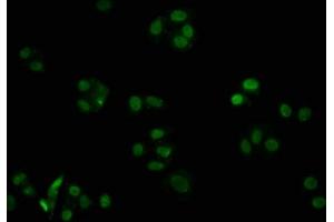 Immunofluorescence staining of HepG2 cells with ABIN7127421 at 1:32. (Recombinant CDKN1B antibody)