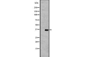 Western blot analysis of extracts from K562 , using OR2V2 antibody.