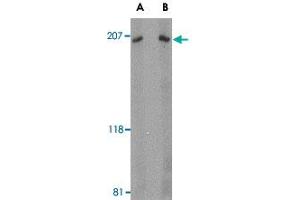 Western blot analysis of ARHGEF17 in Jurkat Cell lysate with ARHGEF17 polyclonal antibody  at (A) 1 and (B) 2 ug/mL . (ARHGEF17 antibody  (Internal Region))