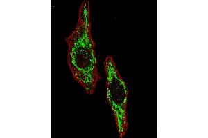 Fluorescent image of  cells stained with HSPD1 (Center) antibody. (HSPD1 antibody  (AA 187-215))