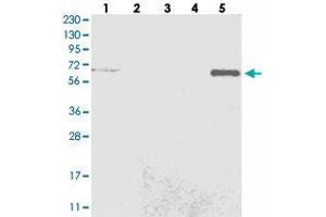 Western blot analysis of Lane 1: RT-4, Lane 2: U-251 MG, Lane 3: Human Plasma, Lane 4: Liver, Lane 5: Tonsil with C6orf190 polyclonal antibody .
