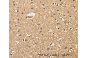 Immunohistochemistry of Human brain  using ALDH8A1 Polyclonal Antibody at dilution of 1:30 (ALDH8A1 antibody)