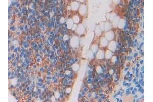 Detection of BLC in Rat Intestine Tissue using Polyclonal Antibody to B-Lymphocyte Chemoattractant (BLC) (CXCL13 antibody  (AA 22-108))