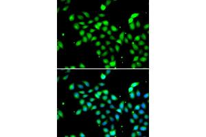 Immunofluorescence analysis of  cells using METTL13 antibody (ABIN6131842, ABIN6143755, ABIN6143757 and ABIN6216265). (METTL13 antibody  (AA 430-699))